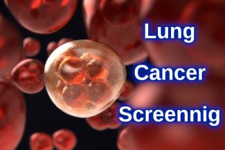 Lung Cancer Screening