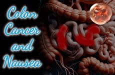 Colon Cancer and Nausea